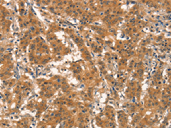 Rabbit Polyclonal Antibody to EID3
