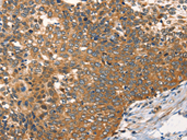 Rabbit Polyclonal Antibody to AGO1