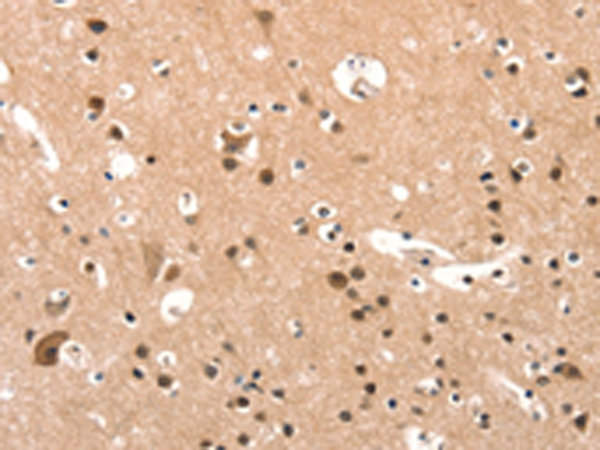 Rabbit Polyclonal Antibody to ELOVL6