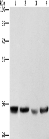 Rabbit Polyclonal Antibody to AIMP1