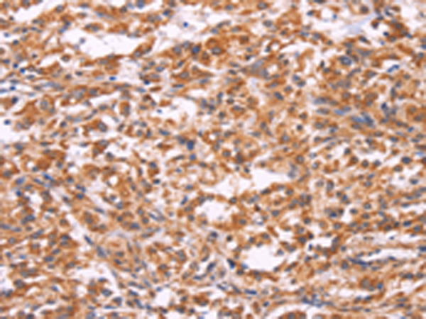 Rabbit Polyclonal Antibody to EMP2
