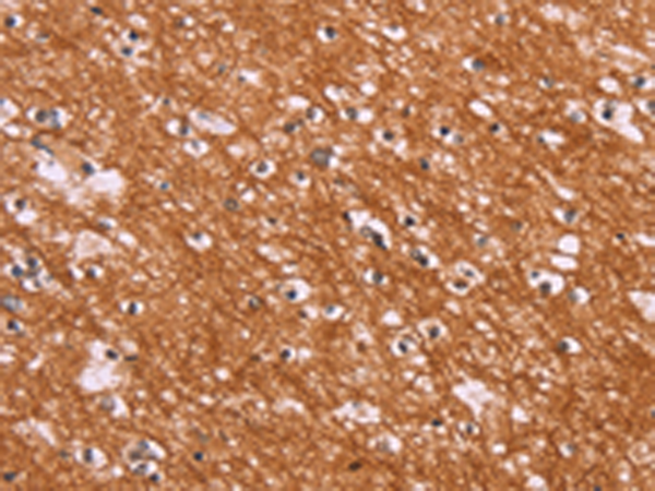 Rabbit Polyclonal Antibody to ENDOG