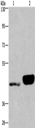 Rabbit Polyclonal Antibody to ENPP4