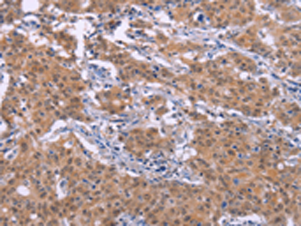 Rabbit Polyclonal Antibody to EP300