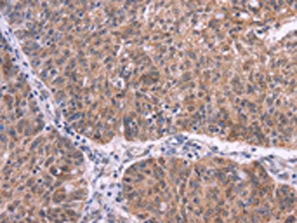 Rabbit Polyclonal Antibody to EFNA5