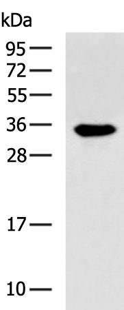 Rabbit Polyclonal Antibody to EPO