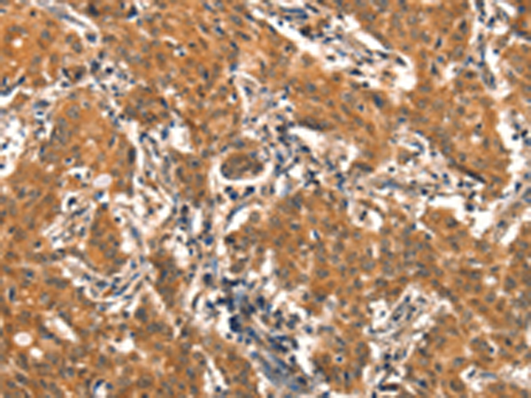 Rabbit Polyclonal Antibody to EPPIN