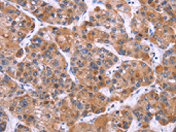 Rabbit Polyclonal Antibody to MSMO1