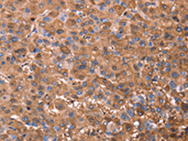 Rabbit Polyclonal Antibody to ERN2