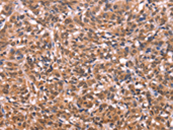 Rabbit Polyclonal Antibody to ESRRB
