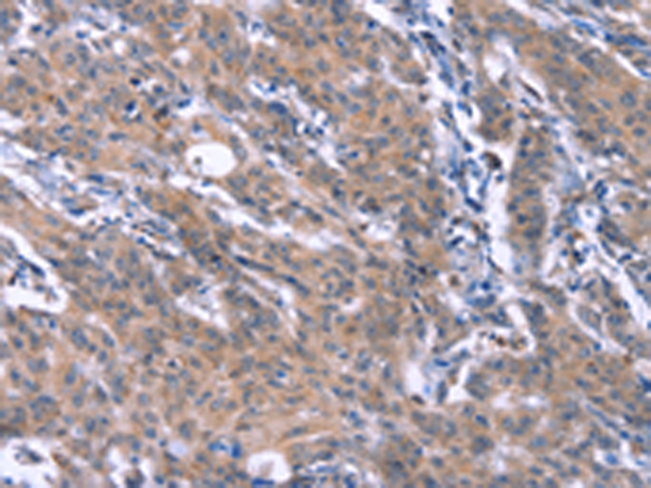 Rabbit Polyclonal Antibody to ESPL1