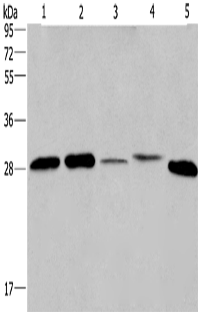 Rabbit Polyclonal Antibody to ETFB