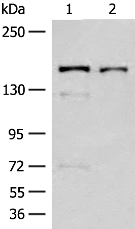Rabbit Polyclonal Antibody to EVC2