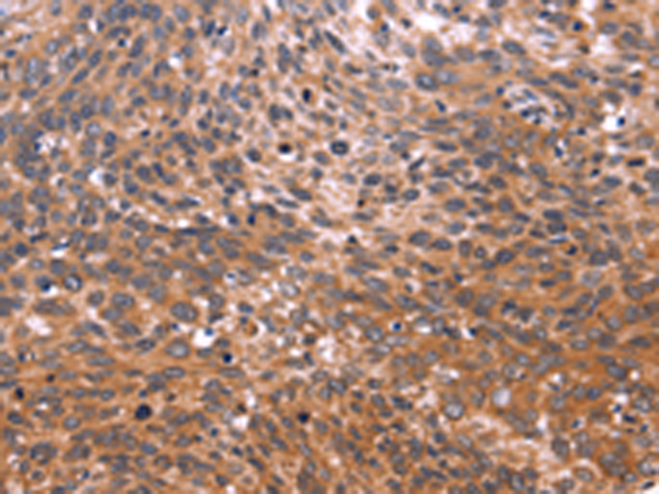 Rabbit Polyclonal Antibody to GCG(Glicentin)