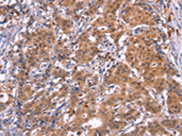 Rabbit Polyclonal Antibody to GCG(GLP2)