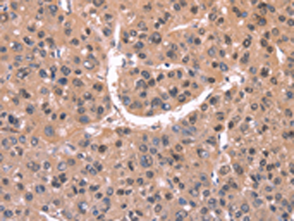 Rabbit Polyclonal Antibody to EXTL1