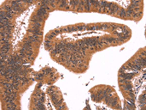 Rabbit Polyclonal Antibody to FAIM