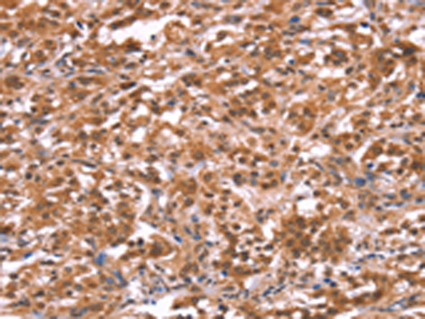 Rabbit Polyclonal Antibody to AMER1