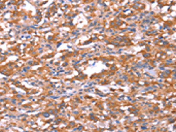 Rabbit Polyclonal Antibody to FAM13B