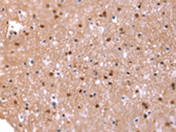 Rabbit Polyclonal Antibody to FAT1