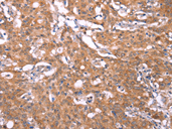 Rabbit Polyclonal Antibody to FBXO31