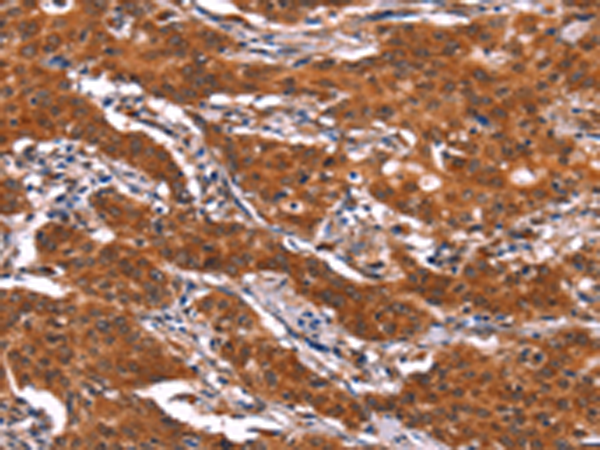 Rabbit Polyclonal Antibody to FEM1B