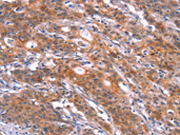 Rabbit Polyclonal Antibody to FEM1A