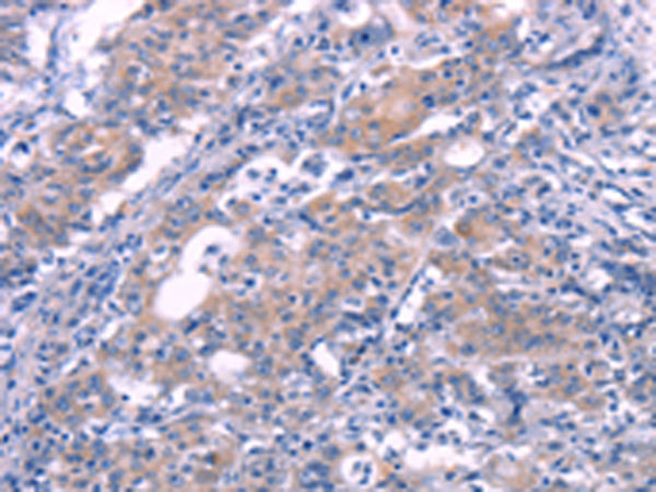 Rabbit Polyclonal Antibody to FGF16