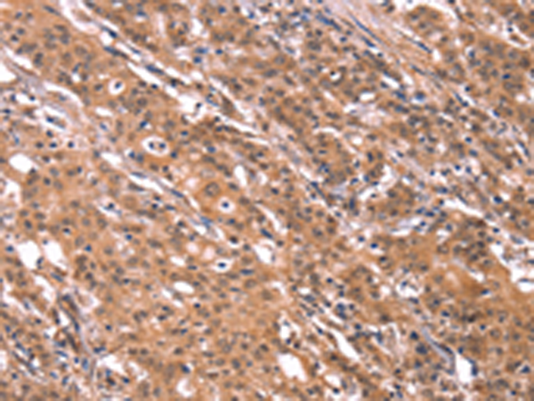 Rabbit Polyclonal Antibody to FGF22