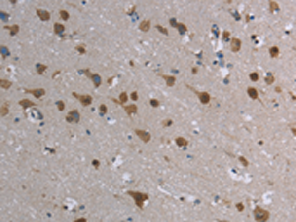 Rabbit Polyclonal Antibody to CASP8AP2