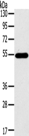 Rabbit Polyclonal Antibody to CFLAR