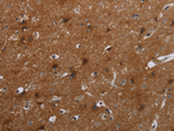 Rabbit Polyclonal Antibody to FMN2