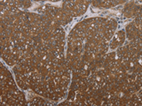 Rabbit Polyclonal Antibody to FOLH1B