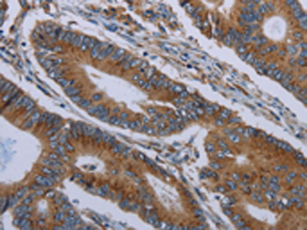 Rabbit Polyclonal Antibody to FPR3