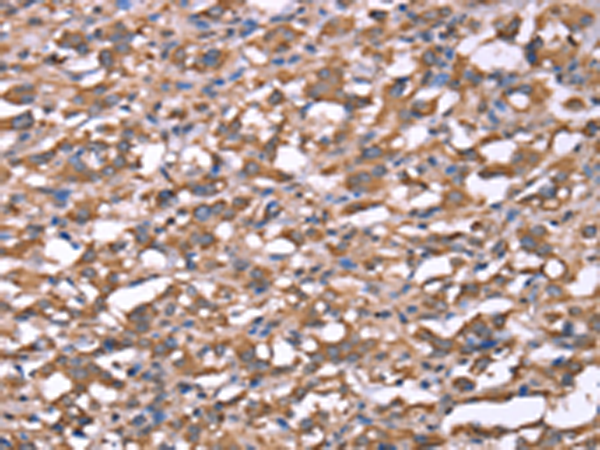 Rabbit Polyclonal Antibody to SPAST