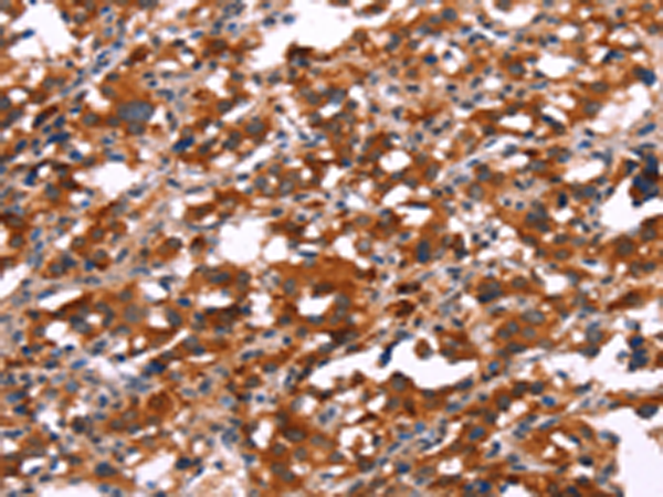 Rabbit Polyclonal Antibody to SLC6A1