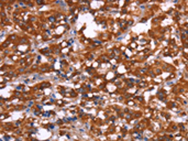Rabbit Polyclonal Antibody to GAGE12I