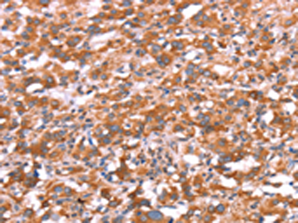 Rabbit Polyclonal Antibody to GAS8