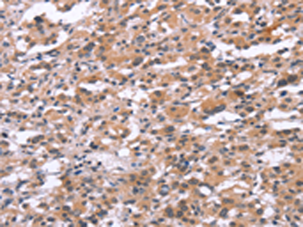 Rabbit Polyclonal Antibody to TUBGCP2