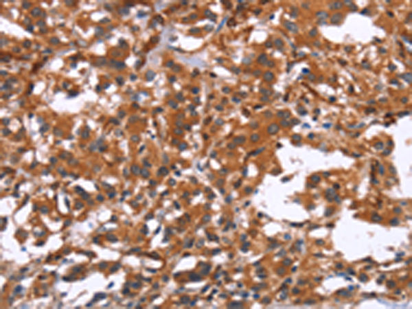 Rabbit Polyclonal Antibody to GPHN