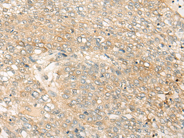 Rabbit Polyclonal Antibody to GHRL