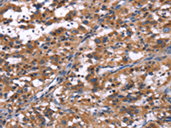Rabbit Polyclonal Antibody to R3HCC1L