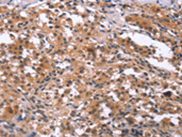 Rabbit Polyclonal Antibody to GCKR