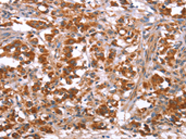 Rabbit Polyclonal Antibody to GLMN