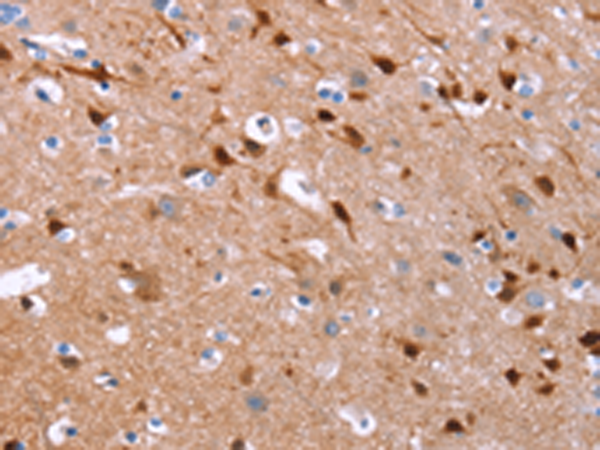Rabbit Polyclonal Antibody to GCGR