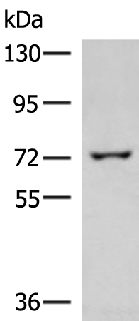Rabbit Polyclonal Antibody to GLS