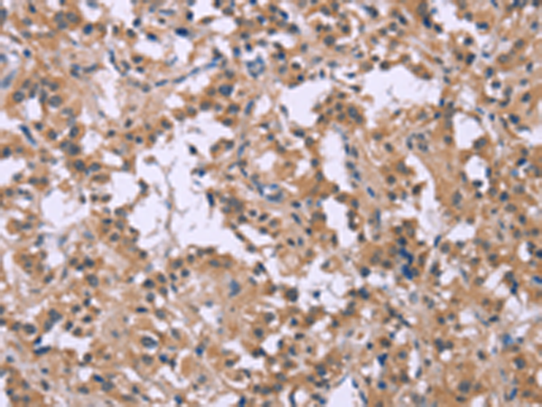 Rabbit Polyclonal Antibody to CSF2RB