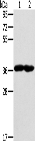 Rabbit Polyclonal Antibody to GNAT3