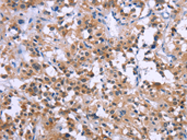 Rabbit Polyclonal Antibody to GNPAT