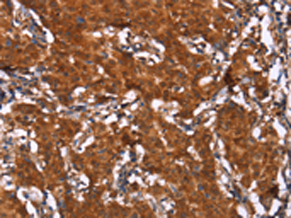 Rabbit Polyclonal Antibody to HCAR2